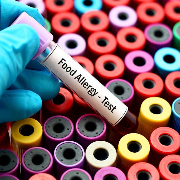 The world is becoming more allergic to food