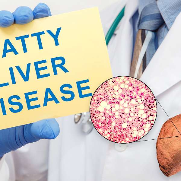 Liver Disease is Up... in Children!